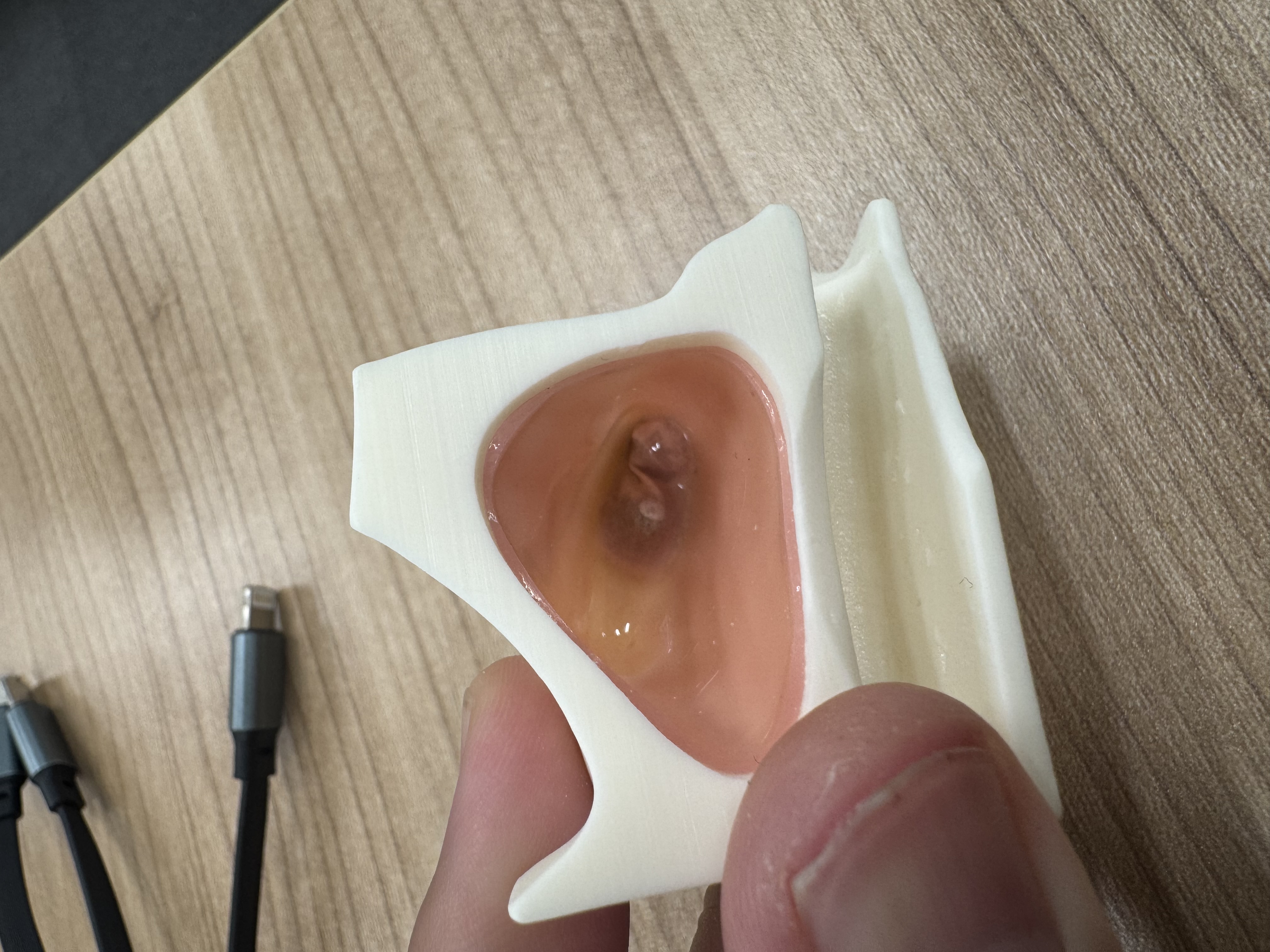 Lateral Approach、Crestal Aapproach