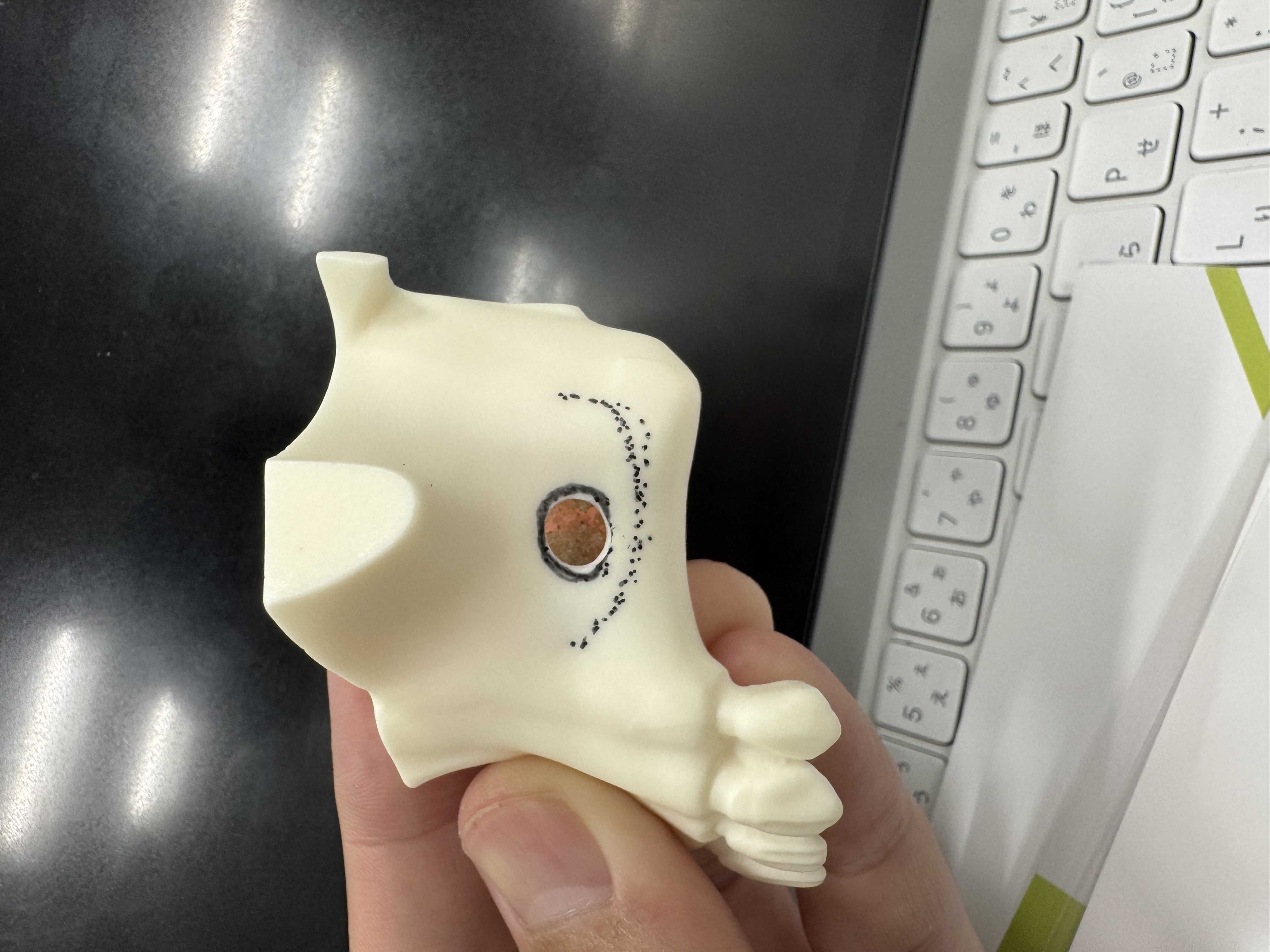 Lateral Approach、Crestal Aapproach