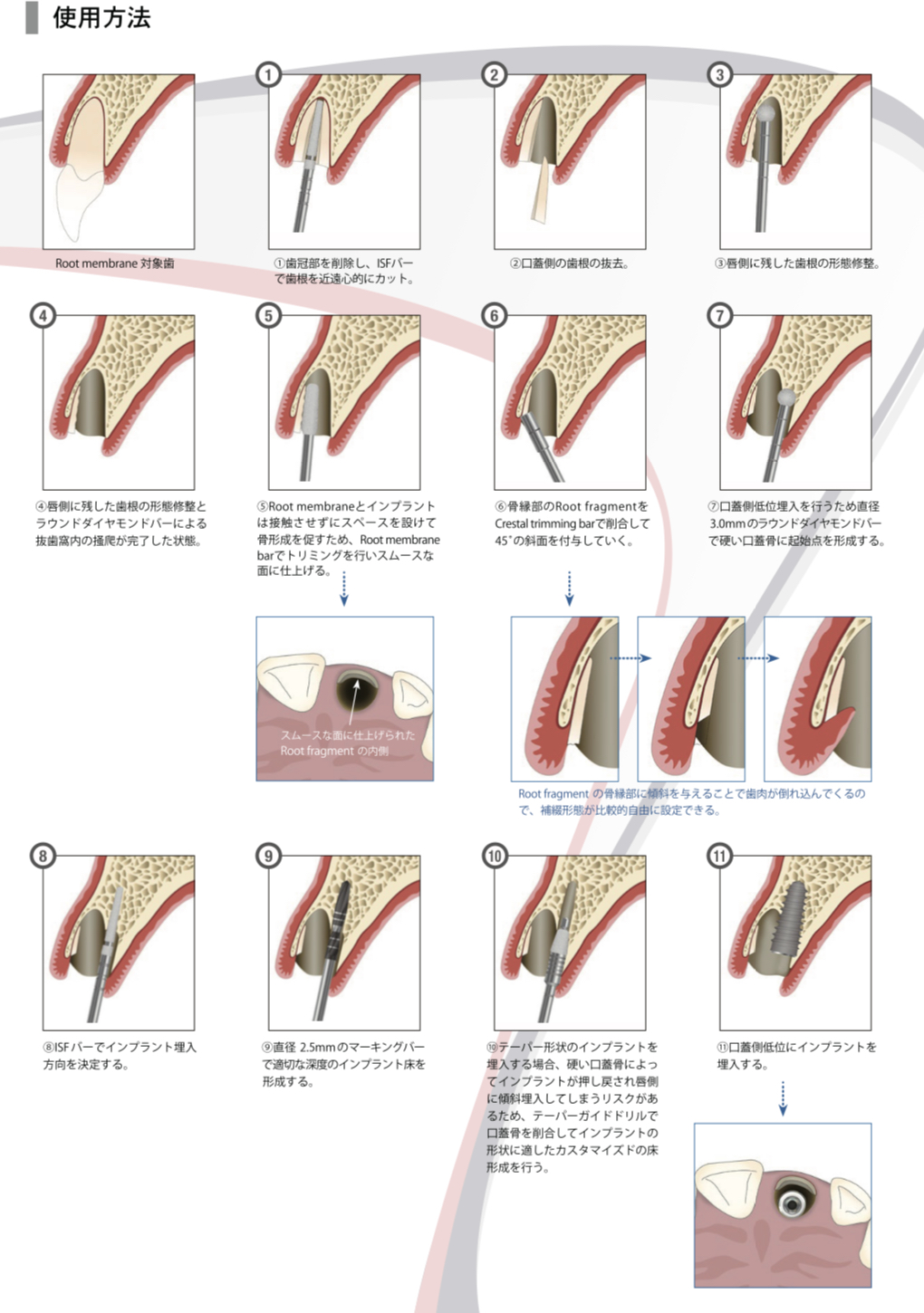 復習