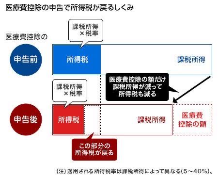 医療費控除について