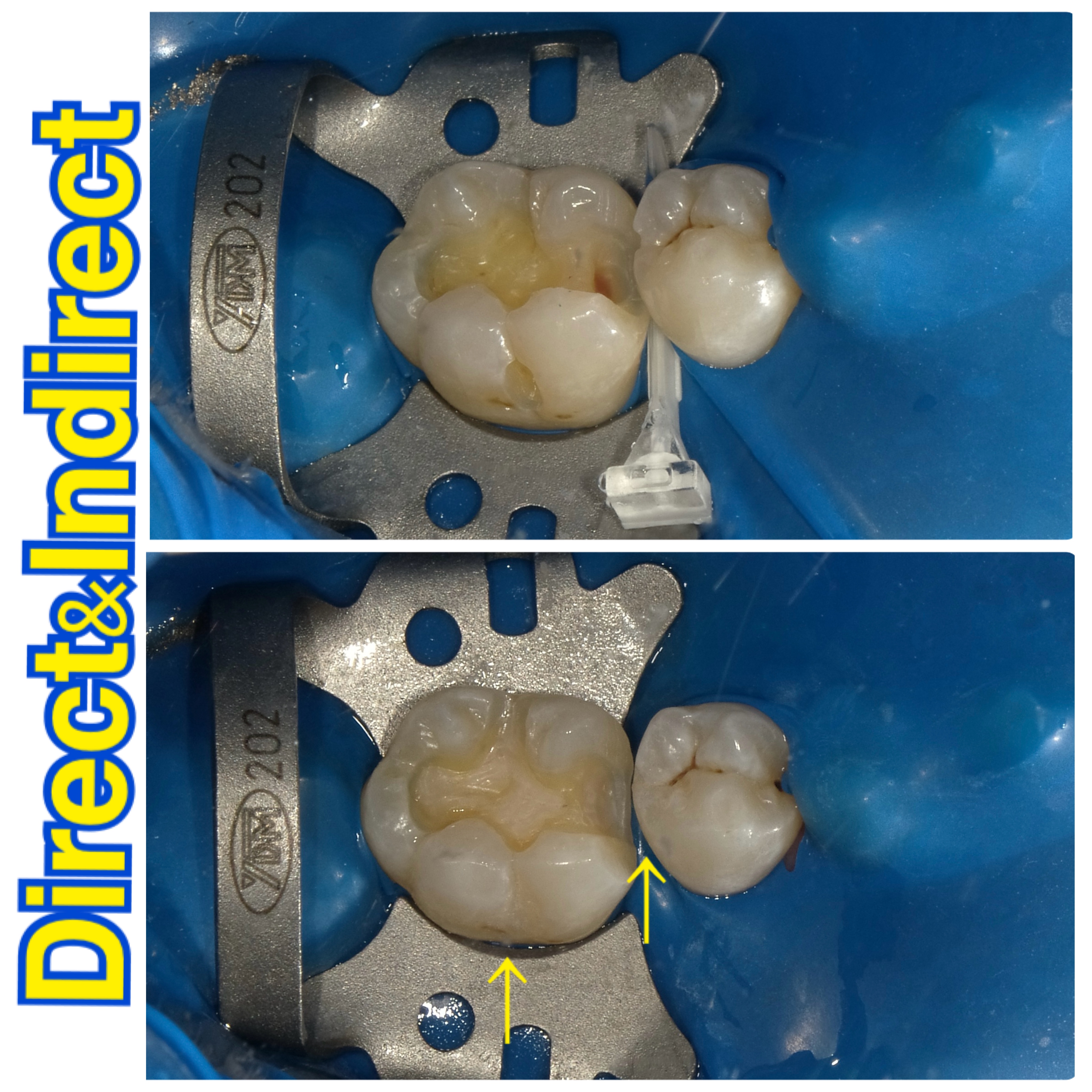 その一手間かけるのが超保存型歯科医院