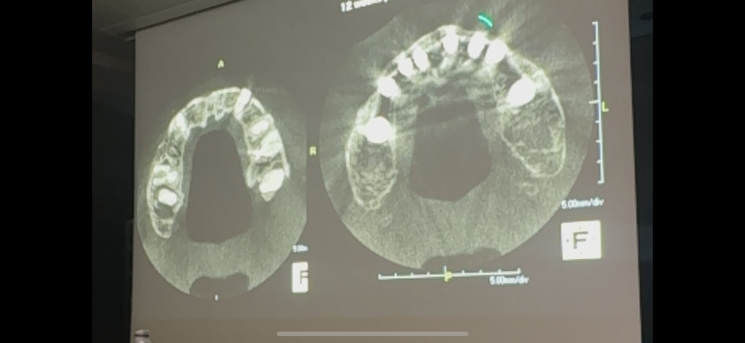 不可能を可能にしたスーパー日本人ドクター
