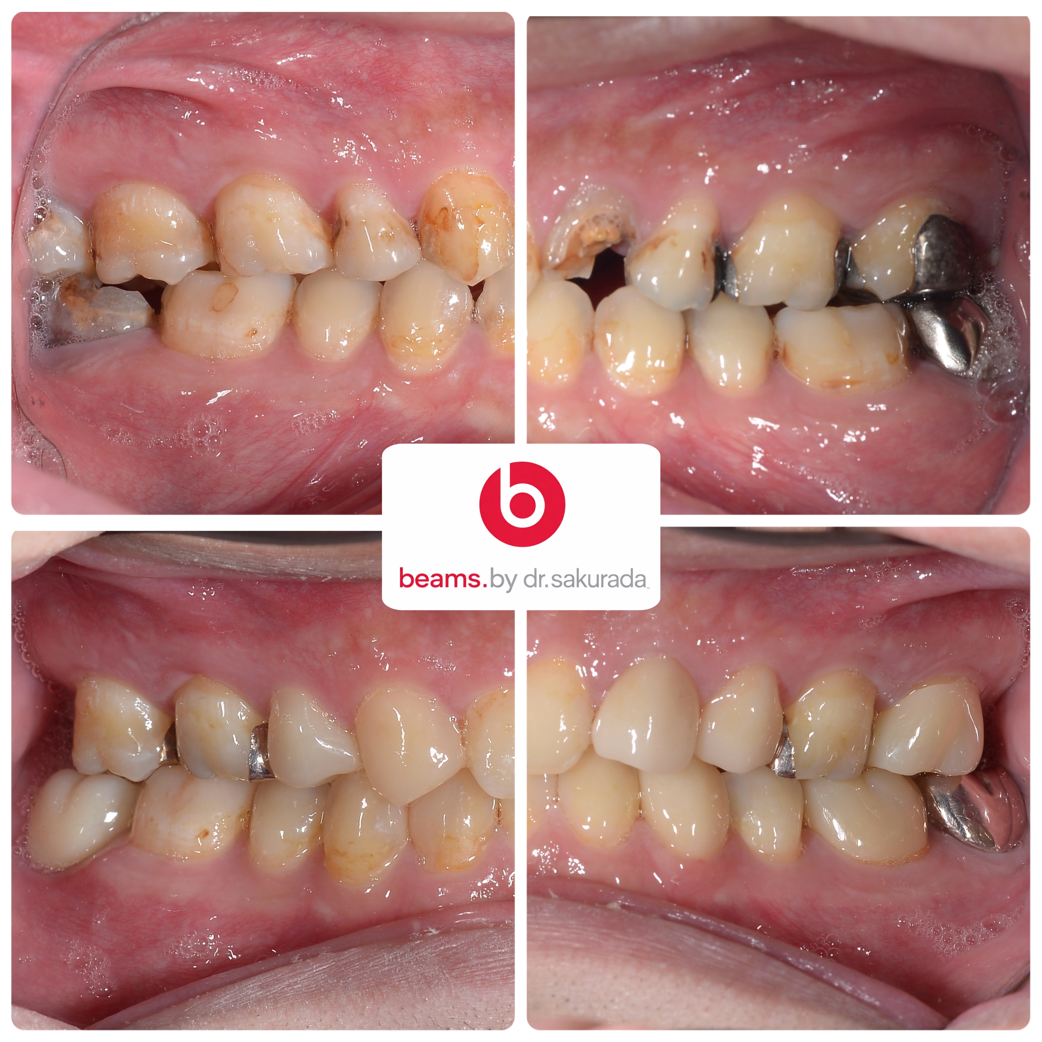 10ヶ月で治療完了