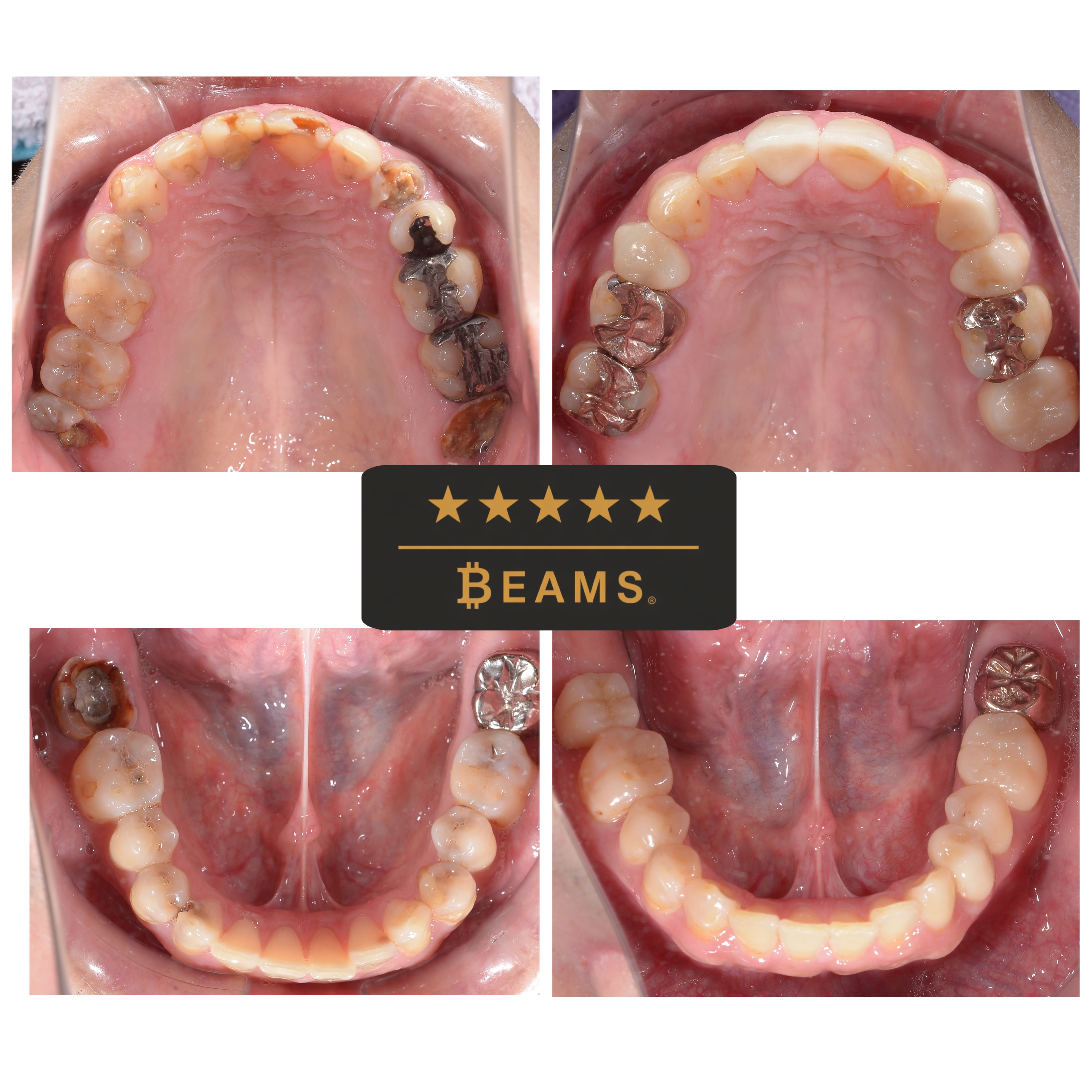 10ヶ月で治療完了