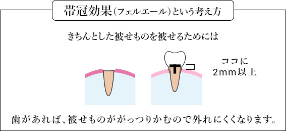 歯の土台も必ずメタルフリーで安心