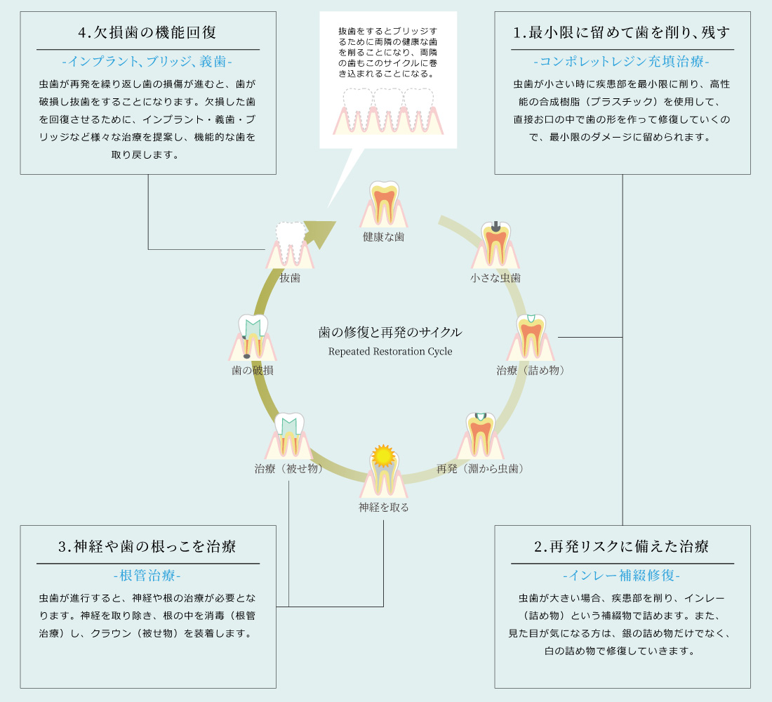 歯の修復と再発サイクル「Repeated Restration Cycle」