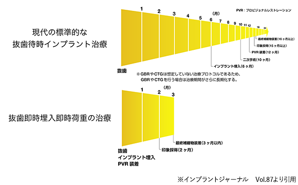 インプラント