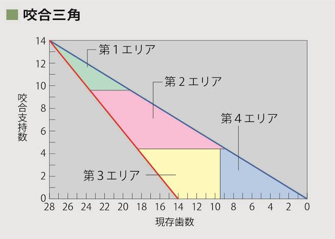 インプラント