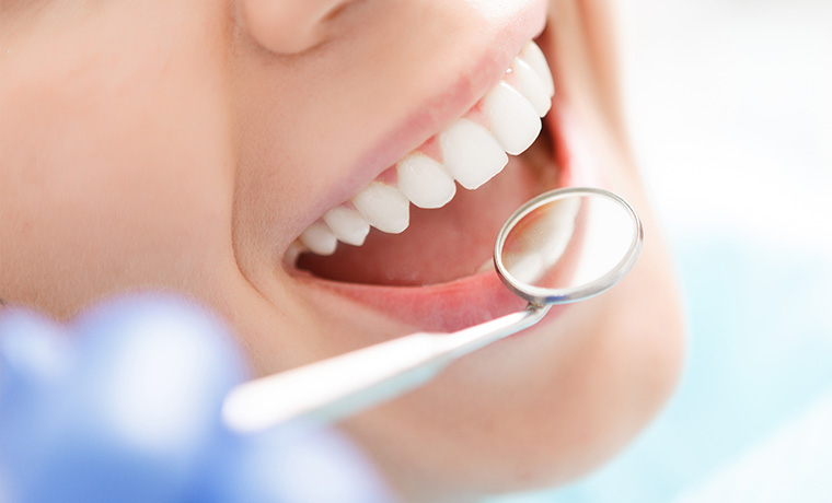 歯茎下がりの治療後もメンテナンスが重要です